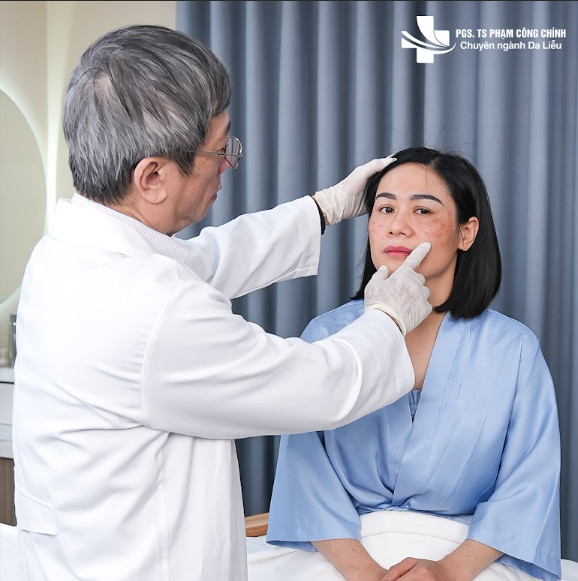 Phương pháp điều trị thâm nám tiên tiến cùng PGS.TS Phạm Công Chính